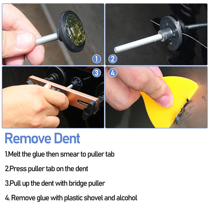 Sonnewelt 57tlg Ausbeulwerkzeug Dellen Reparatur Set Auto